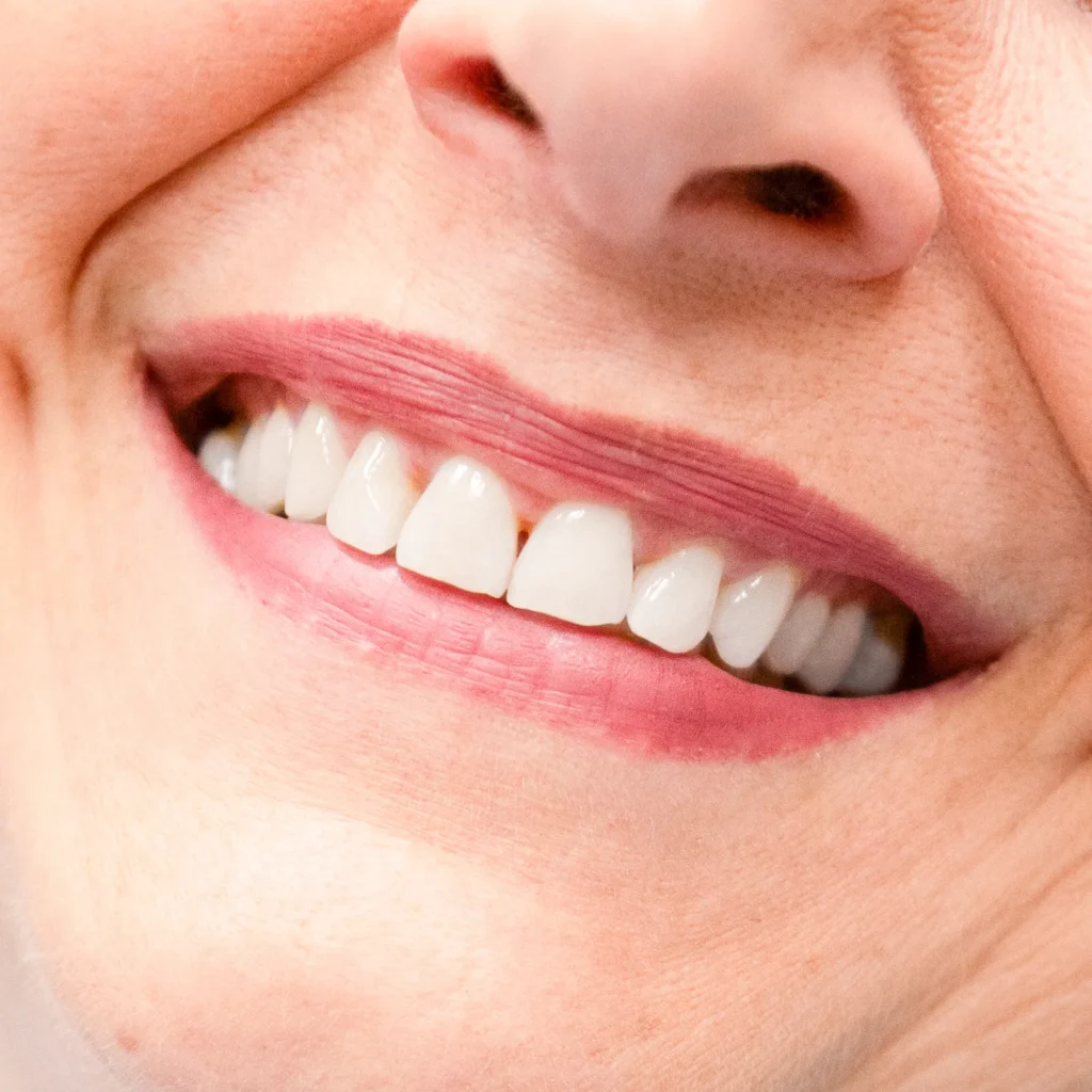 Foto: dettaglio sorriso