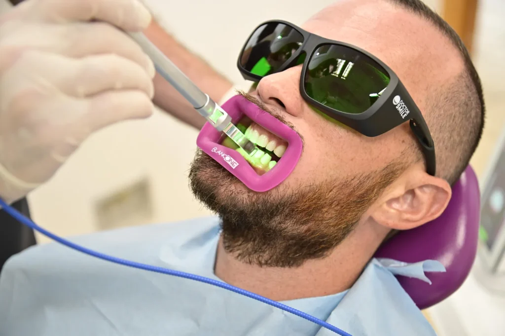 Sbiancamento dentale · Gruppo Odontoiatrico Tuscolano