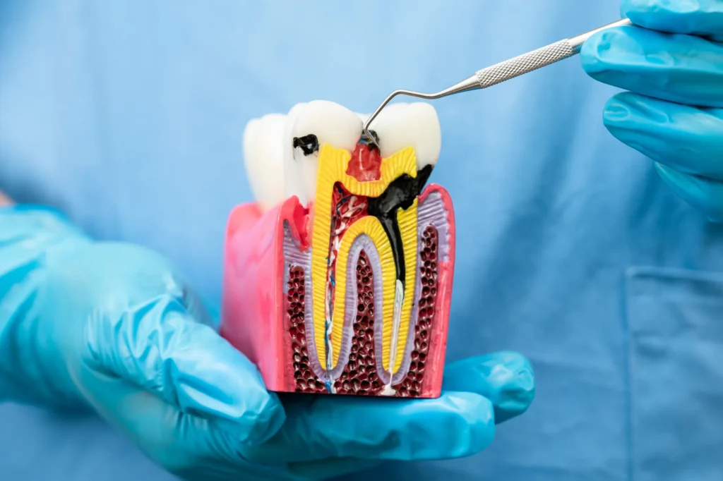 Endodonzia · Gruppo Odontoiatrico Tuscolano